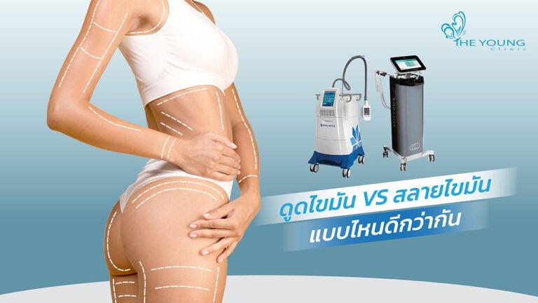 ดูดไขมัน vs สลายไขมันด้วยความเย็น