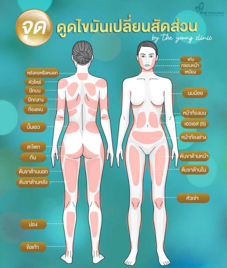 liposculpture