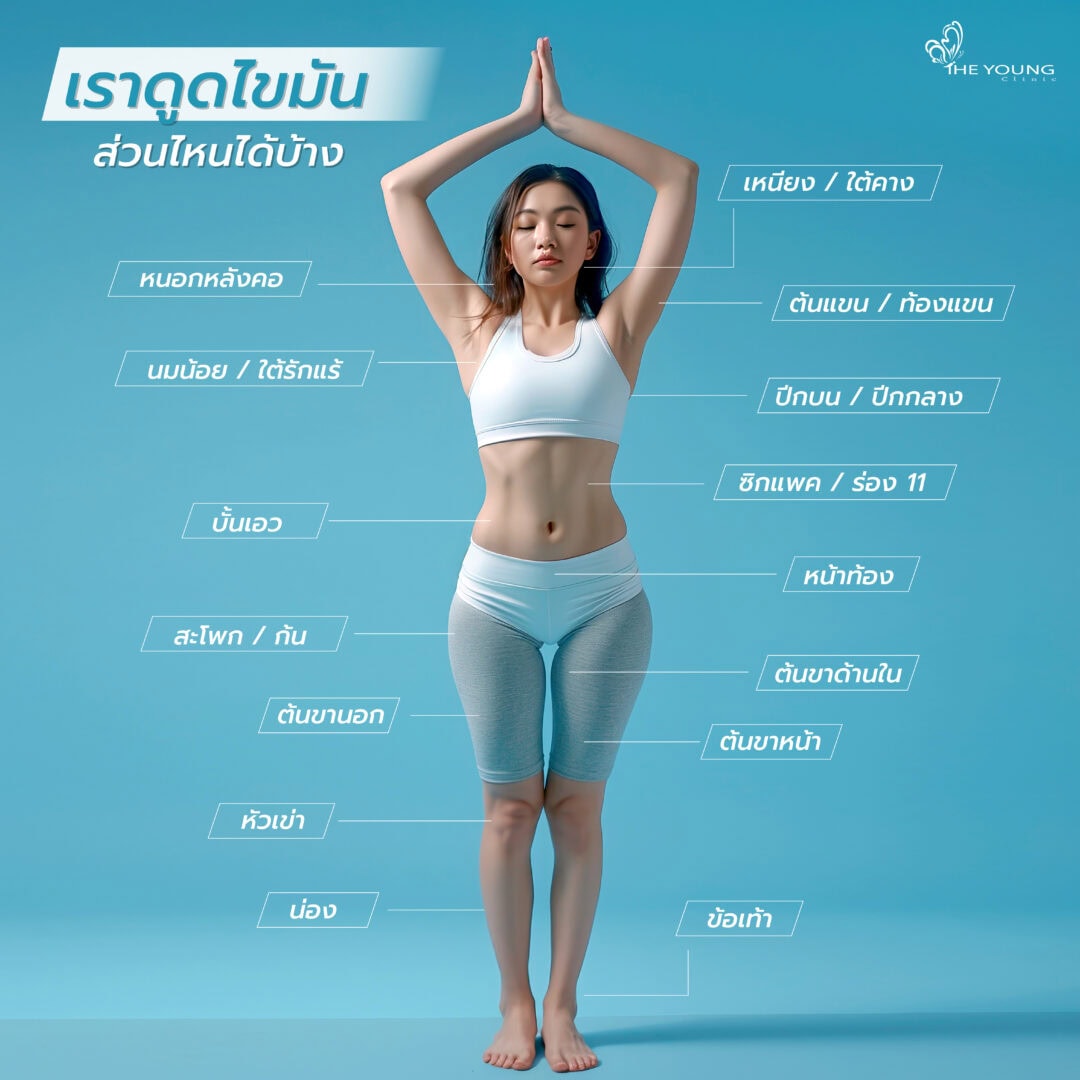 ดูดไขมัน ตรงไหนได้บ้าง