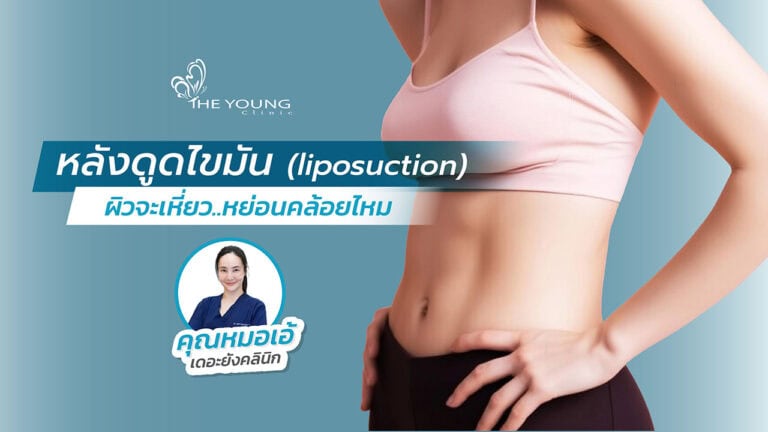 ดูดไขมันแล้วผิวจะเหี่ยวยานไหม
