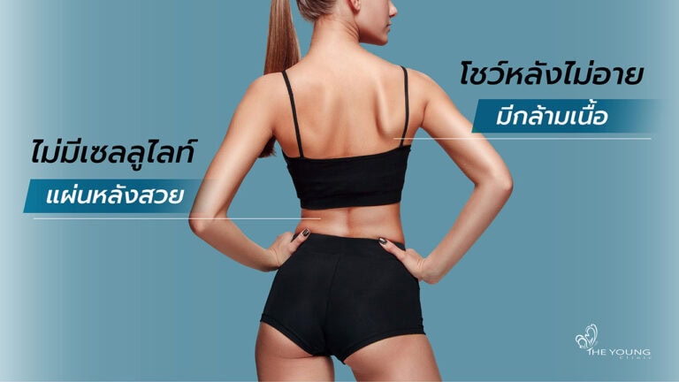 ลดเซลลูไลท์แผ่นหลัง