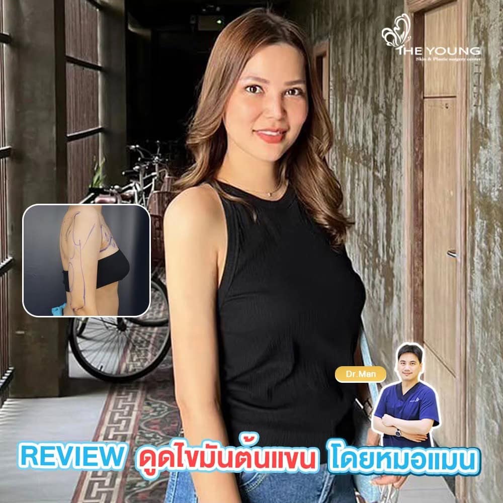 ดูดไขมันต้นแขน