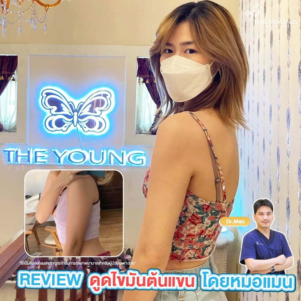 ลดต้นแขน