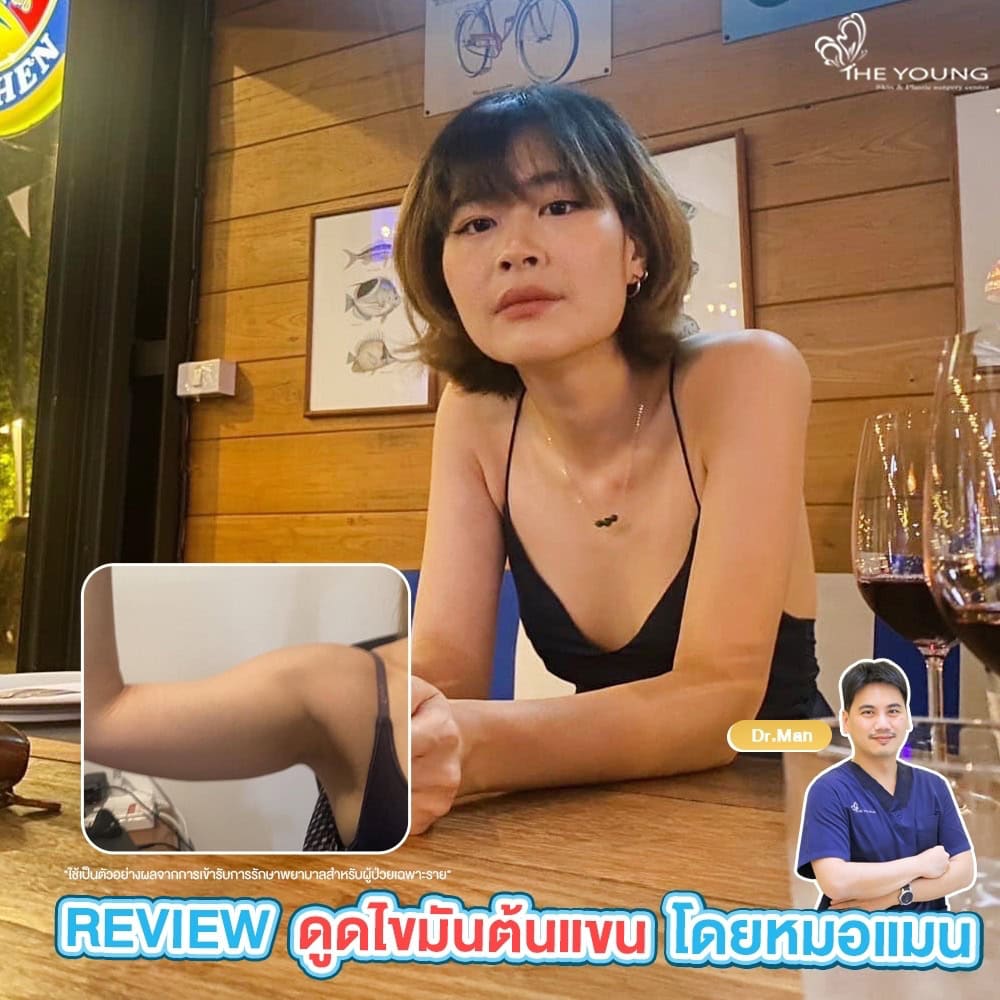 ดูดไขมัน ลดต้นแขน
