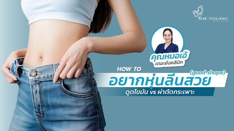 ดูดไขมัน หรือผ่าตัดกระเพาะดีกว่ากัน