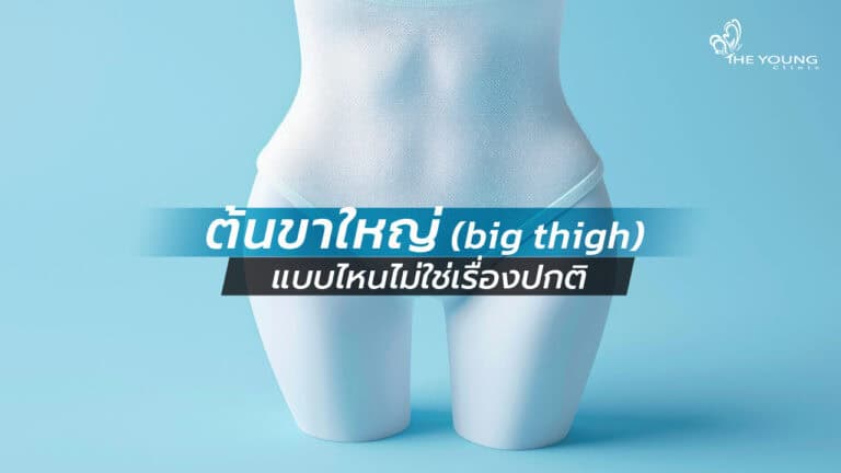 ต้นขาใหญ่ ลดยังไง