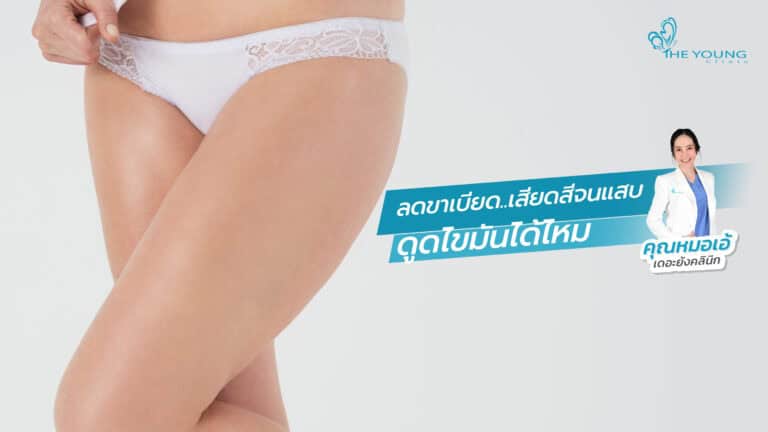 ดูดไขมัน ลดขาเบียดได้ไหม
