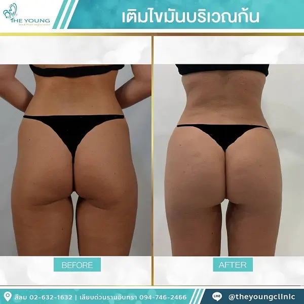 Universe Curve เห็นสัดส่วนชัดขึ้นได้จากเคสจริงที่ดูแลโดยแพทย์