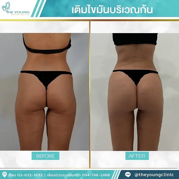 Universe Curve เห็นสัดส่วนชัดขึ้นได้จากเคสจริงที่ดูแลโดยแพทย์