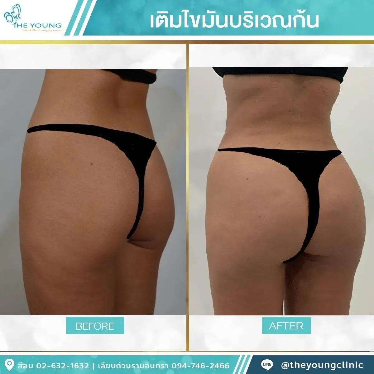 Universe Curve เห็นสัดส่วนชัดขึ้นได้จากเคสจริงที่ดูแลโดยแพทย์