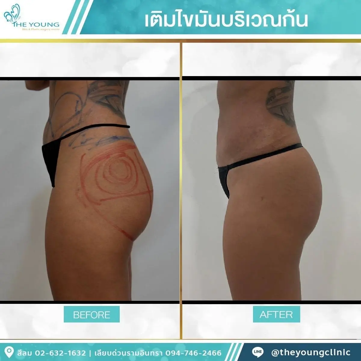 Universe Curve เห็นสัดส่วนชัดขึ้นได้จากเคสจริงที่ดูแลโดยแพทย์