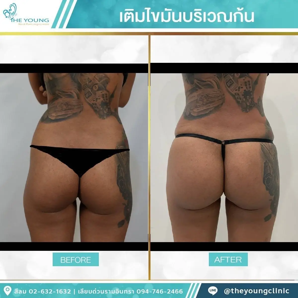 Universe Curve เห็นสัดส่วนชัดขึ้นได้จากเคสจริงที่ดูแลโดยแพทย์