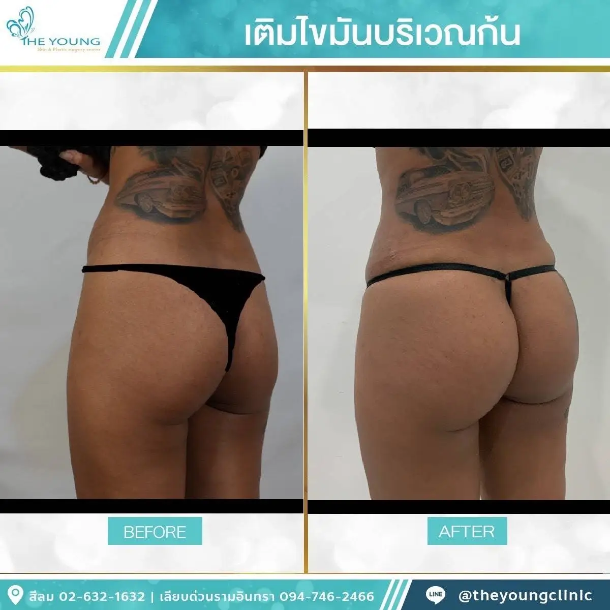Universe Curve เห็นสัดส่วนชัดขึ้นได้จากเคสจริงที่ดูแลโดยแพทย์