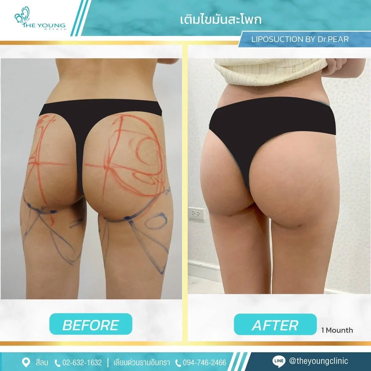Universe Curve เห็นสัดส่วนชัดขึ้นได้จากเคสจริงที่ดูแลโดยแพทย์